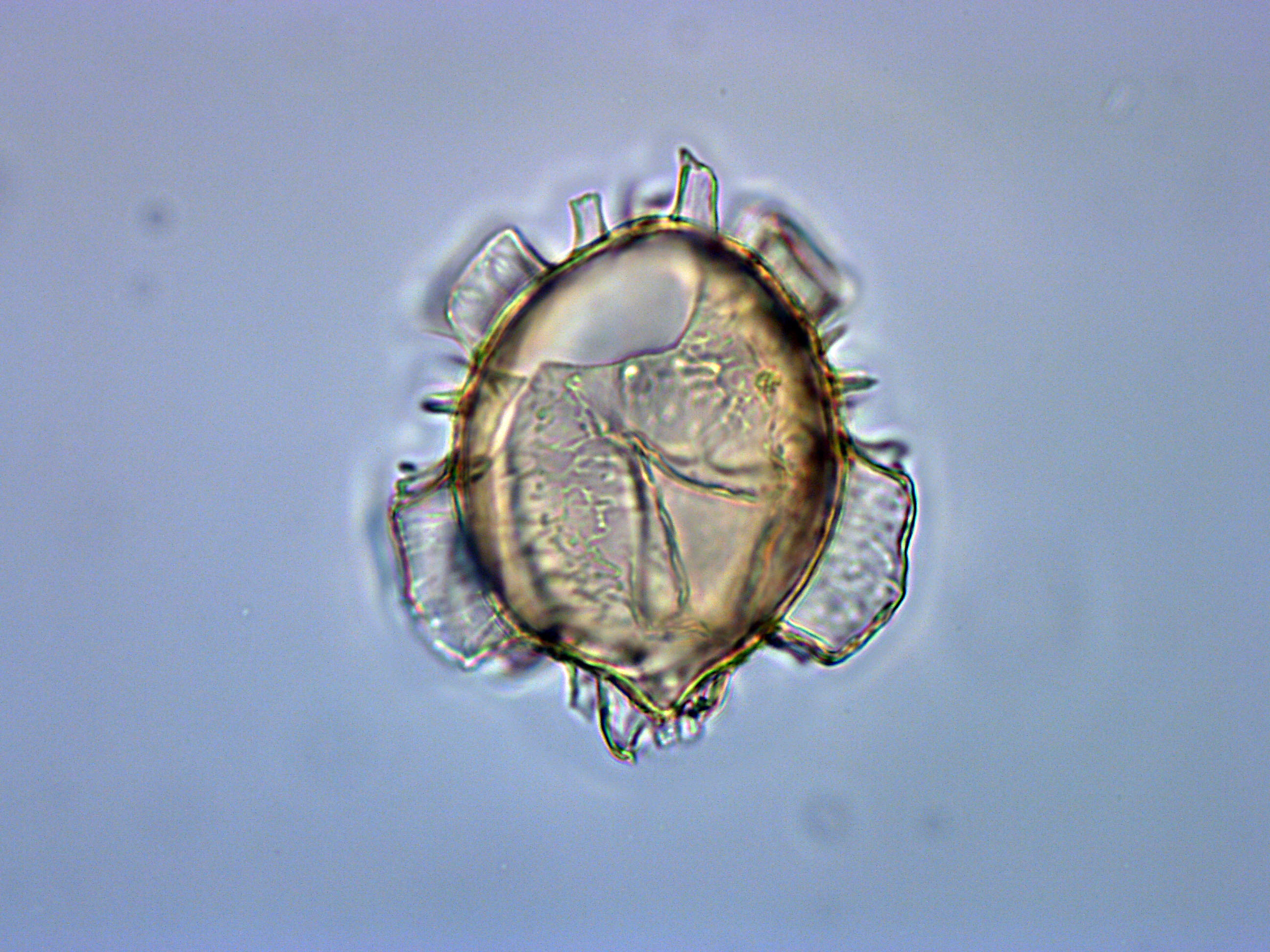 Achilleodinium biformoides, 1410A-13H-6, 65-67, X19, foto-b.jpg